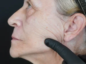 lassita e rigenerazione