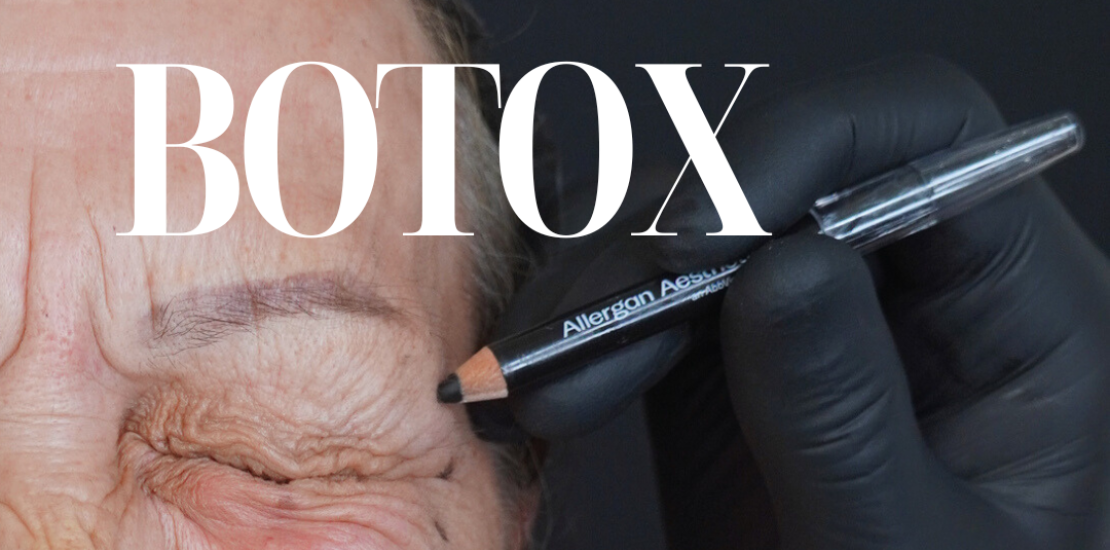 botox roma, medicinaesteticaroma, rughe roma
